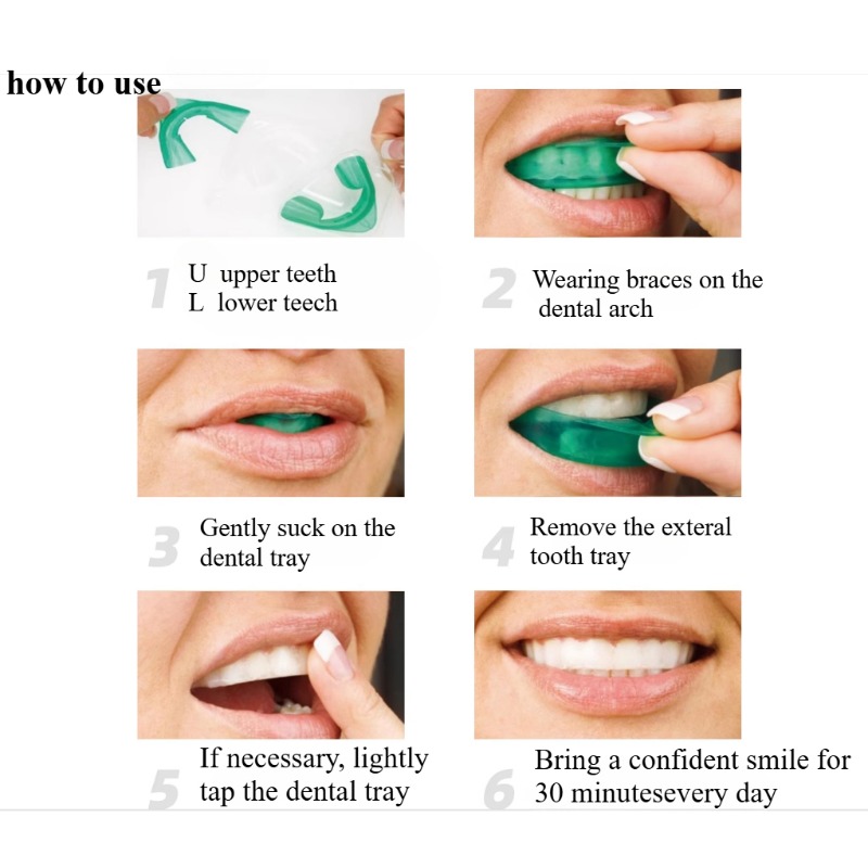 Set Teeth Whitening Tray U-sha - Teeth Whitening Levels review and price