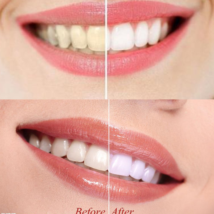 Bamboo Charcoal Teeth Tooth De - Teeth Whitening Levels review and price