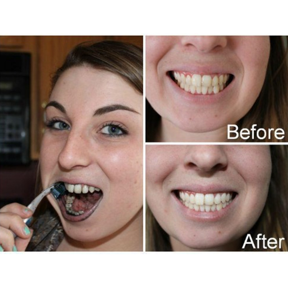 Bamboo Charcoal Teeth Tooth De - Teeth Whitening Levels review and price
