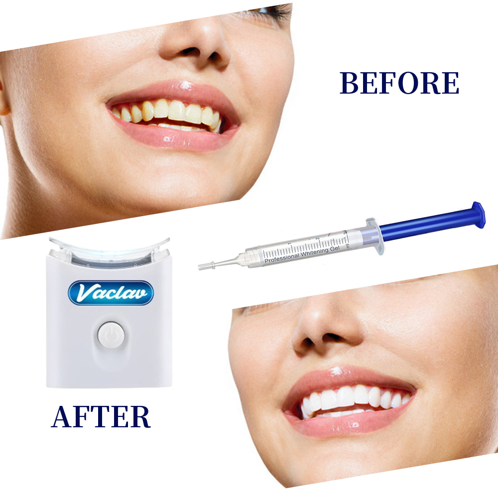 Mint Teeth Whitening Gel Syrin - Teeth Whitening Kit At Home review and price