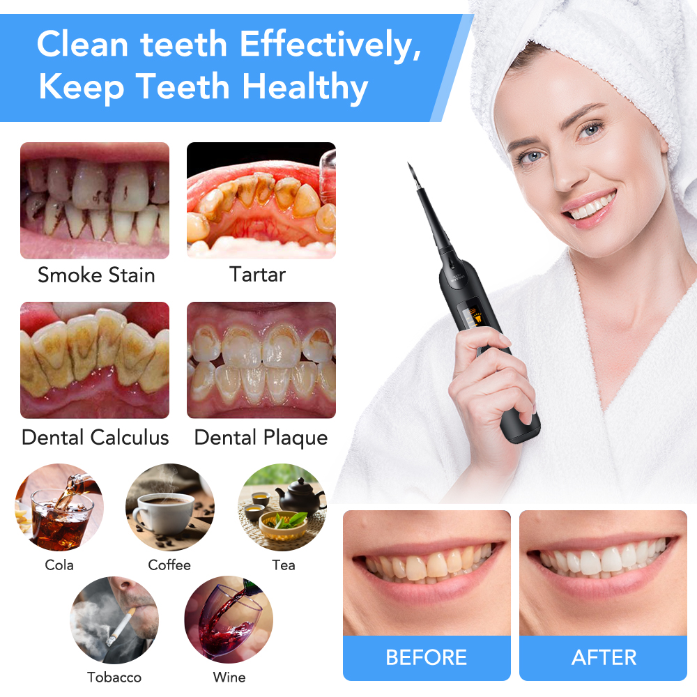 Teeth Tartar Remover Electric  - Teeth Whitening Kit At Home review and price