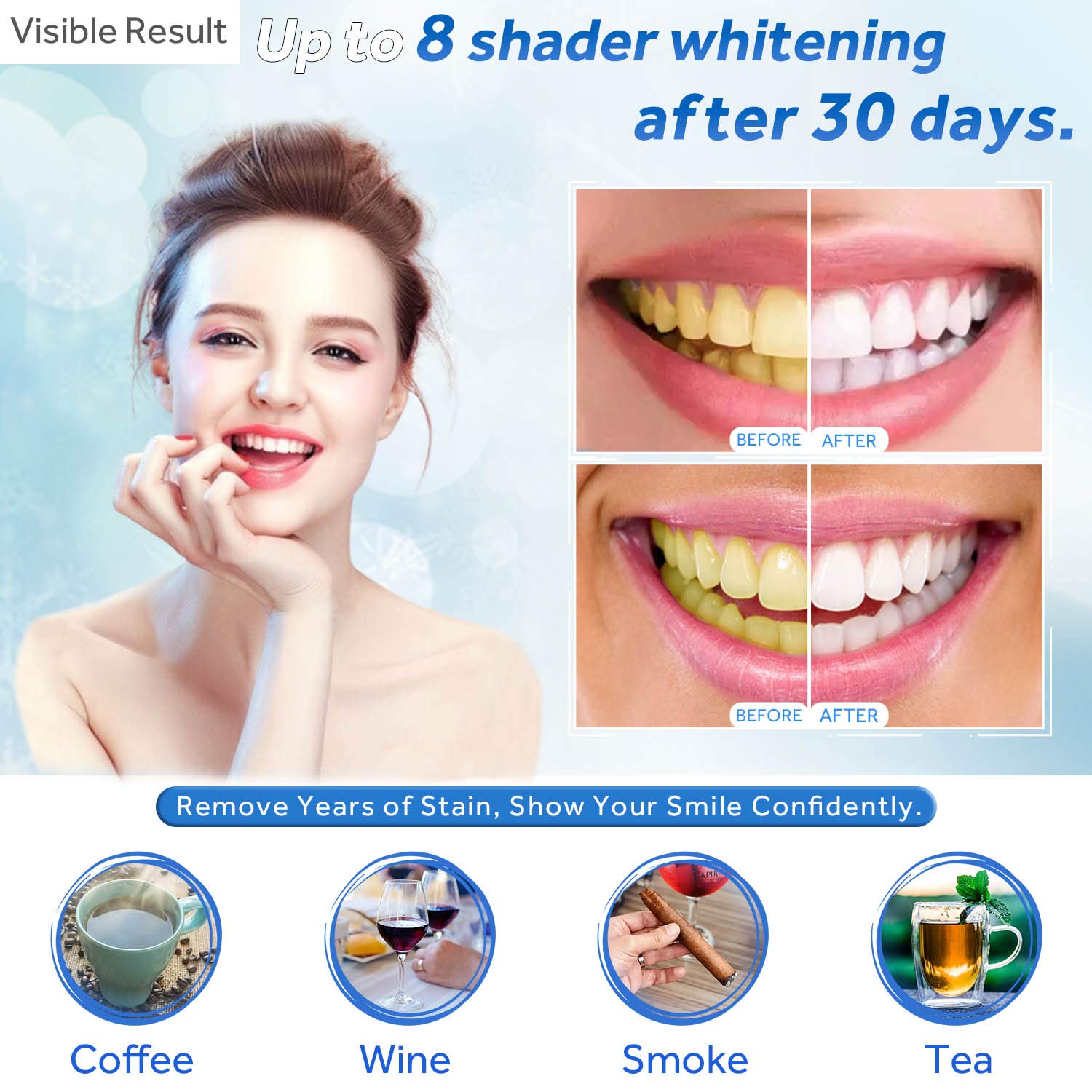 Teeth Whitening Gel Refill Syr - Teeth Whitening Levels review and price