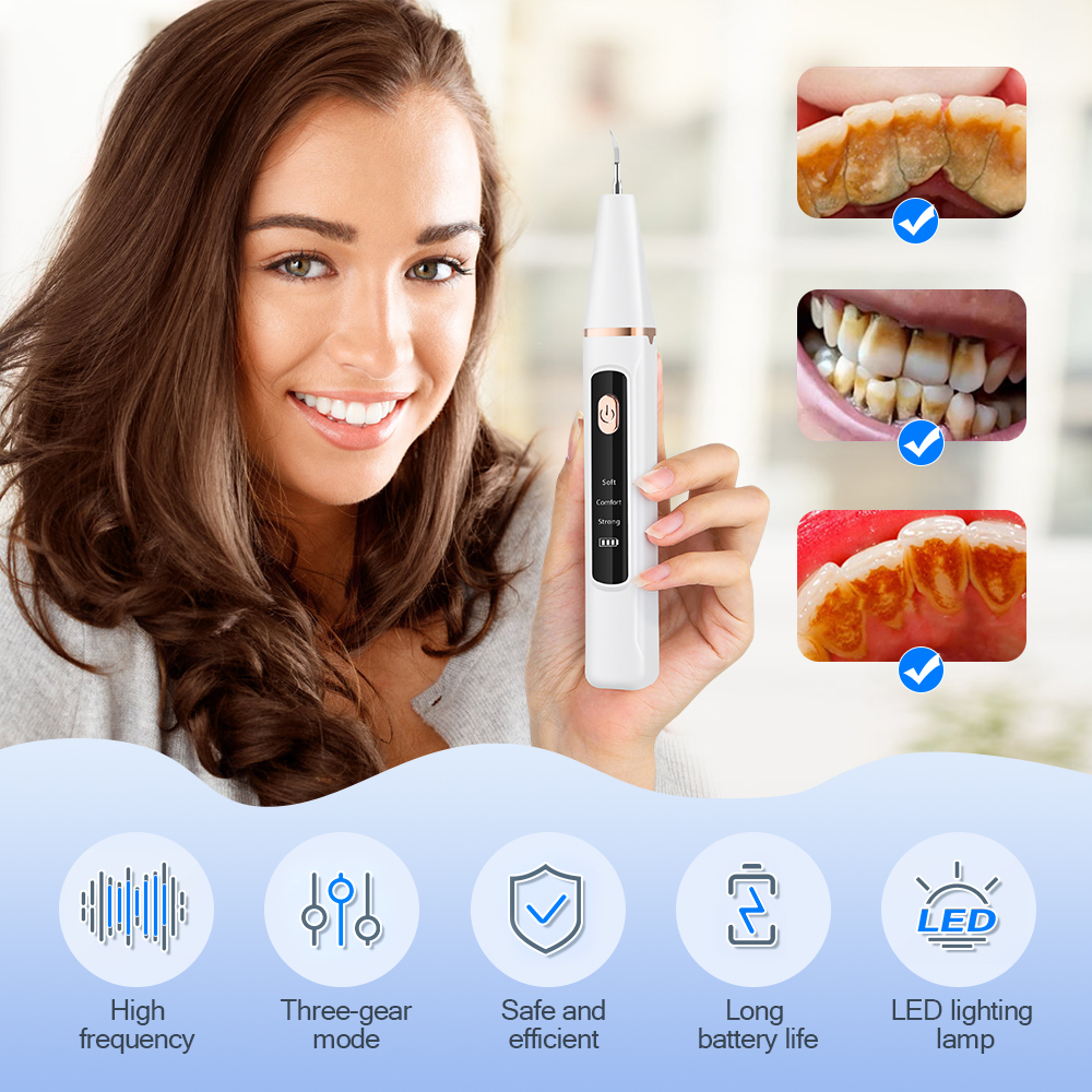 Electric Ultrasonic Dental Sca - Teeth Whitening Uk review and price