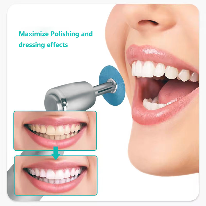 40pcs Dental Polishing Discs H - Teeth Whitening Uk review and price