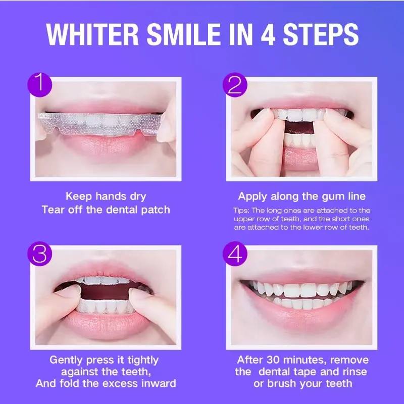 Teeth Whitening Kit - 5X LED L - Teeth Whitening Levels review and price