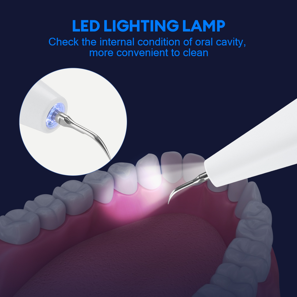 Ultrasonic Dental Calculus Rem - Teeth Whitening Uk review and price