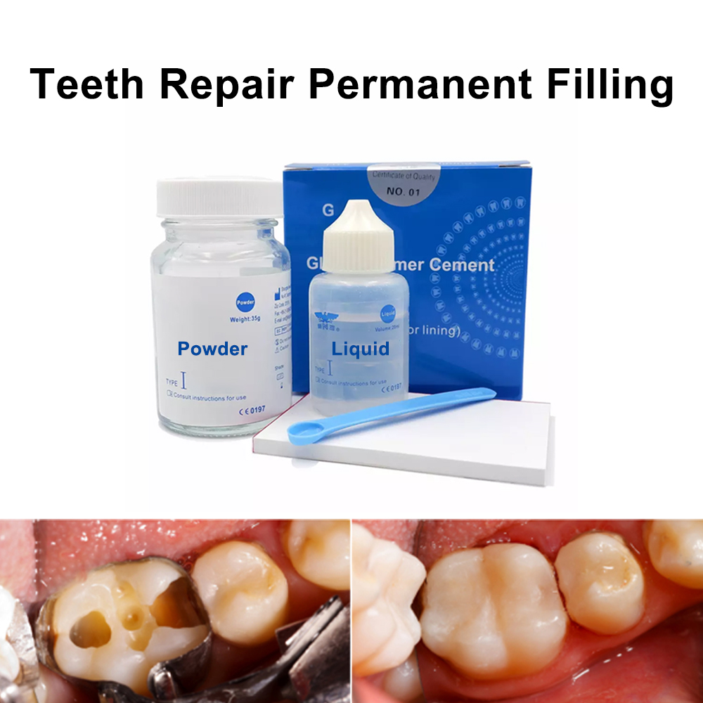 Permanent Teeth Filling Repair - Teeth Whitening Kit At Home review and price