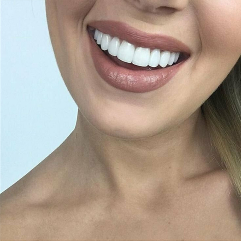 New Easy to Match with Makeup  - Teeth Whitening Routine review and price