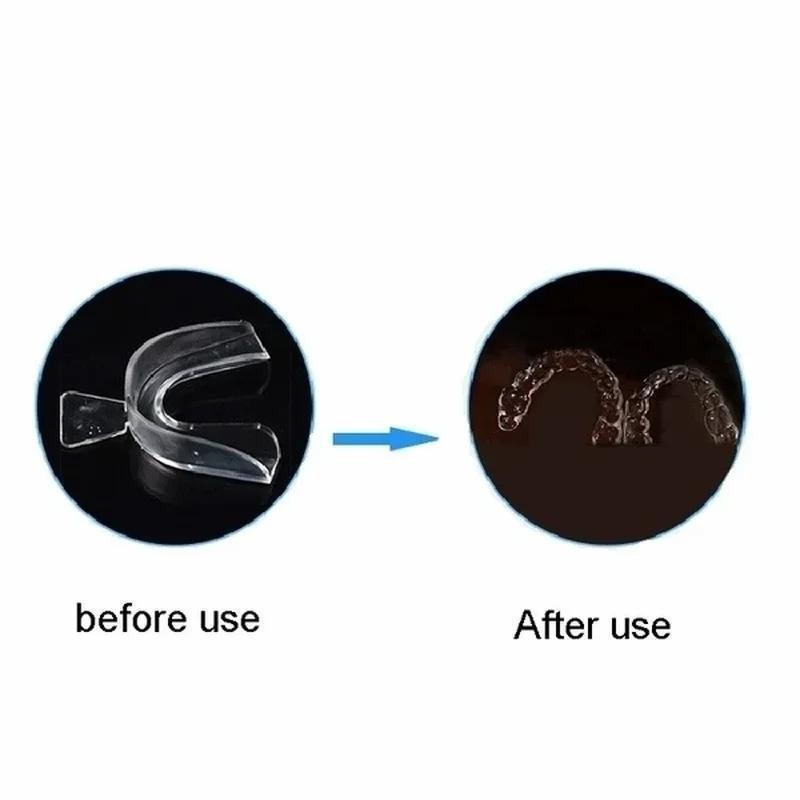 Professional Teeth Whitening T - Teeth Whitening Kit At Home review and price