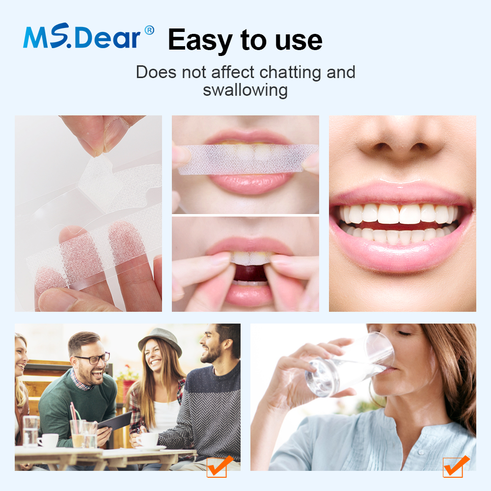 Teeth Whitening Strips Cleansi - Teeth Whitening Levels review and price
